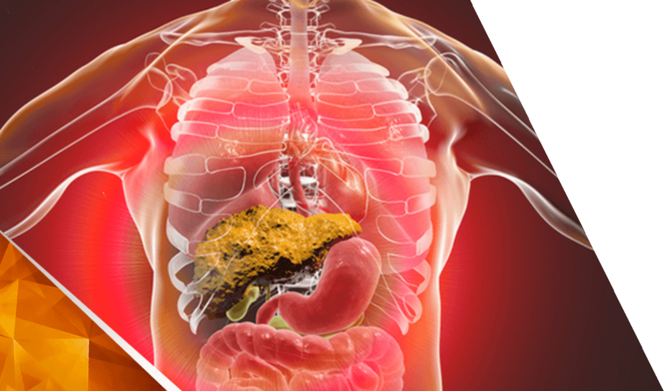 Causas y tratamiento para manejar la cirrosis hepática